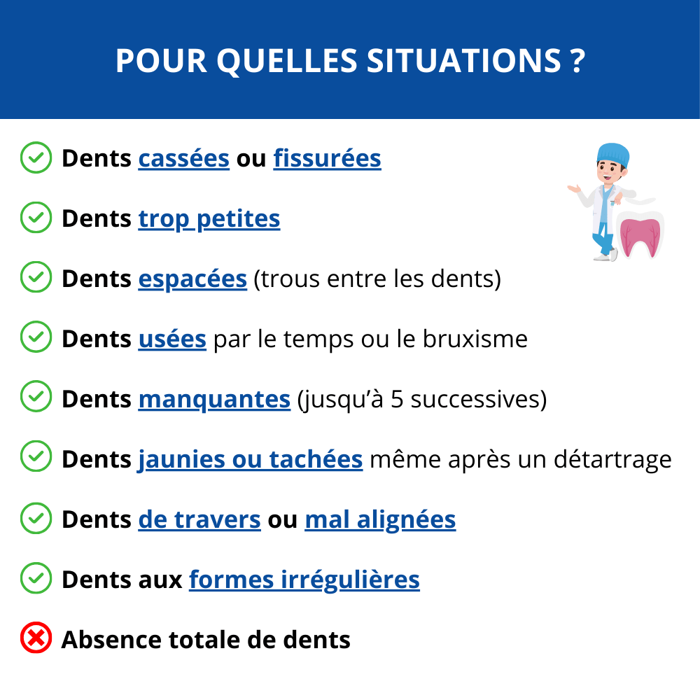 DentalFlex™ | Set de facettes modulables (haut et bas)