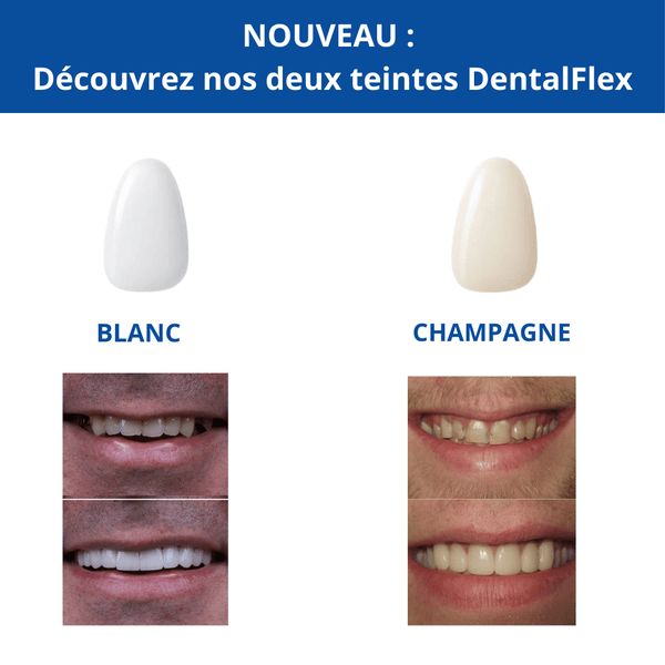DentalFlex™ | Set de facettes modulables (haut et bas)